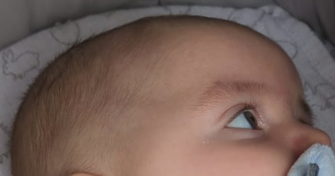 To worry about my LO’s eyebrows