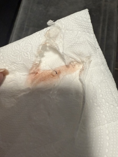 Could this be implantation bleeding?!