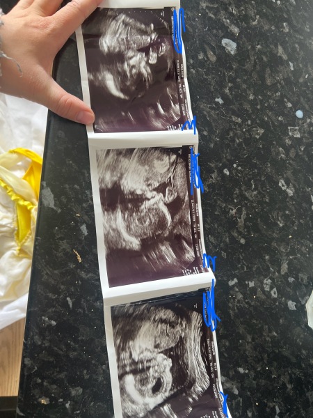November 2025 #Thread 2 🤰🏻