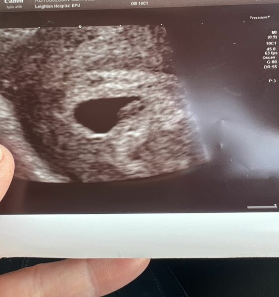 Due February 2026 ✨