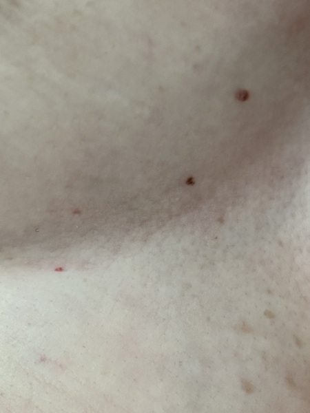 Mole