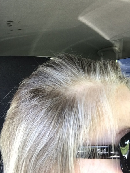 New Hair Growth is White - highlighting options?