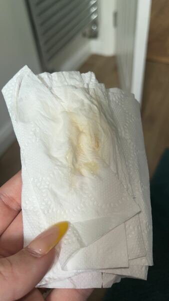 Is this my mucus plug??