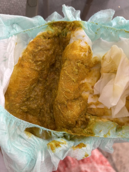 Powder Kendamil nappy / combo feeding - is this normal ? NAPPY PIC