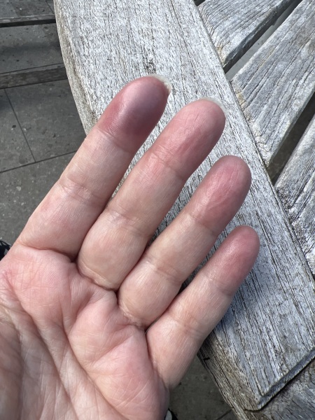 Slammed my finger in the door last night