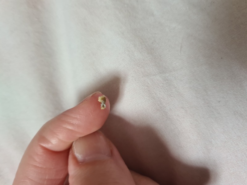 My ear piercing just made my day!