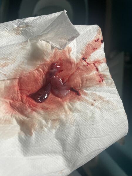 12 weeks after birth bleeding sensitive image..