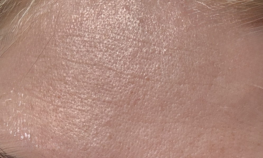 Skin concern