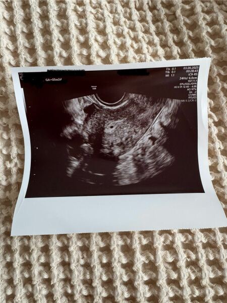 No yolk 5 weeks 2 days