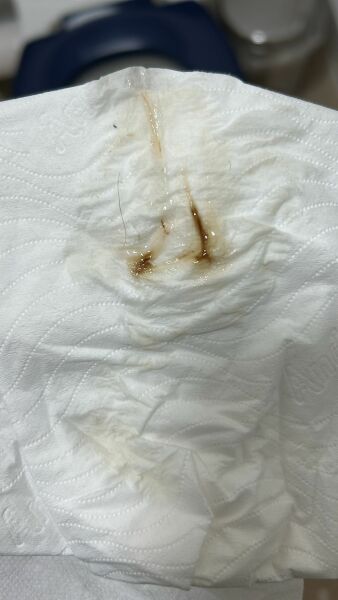 5days after period what is this?