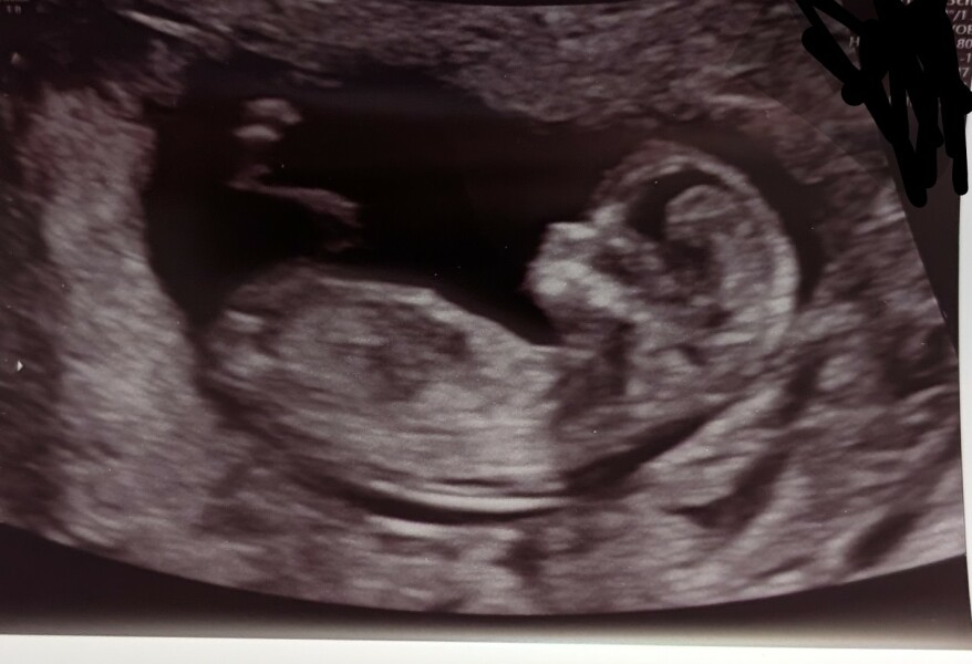 Due January 2026 ✨