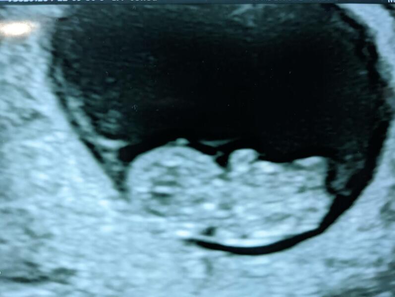 Scan - when to have