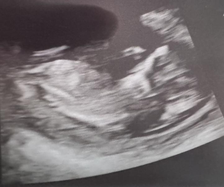 Anyone care to guess the gender?