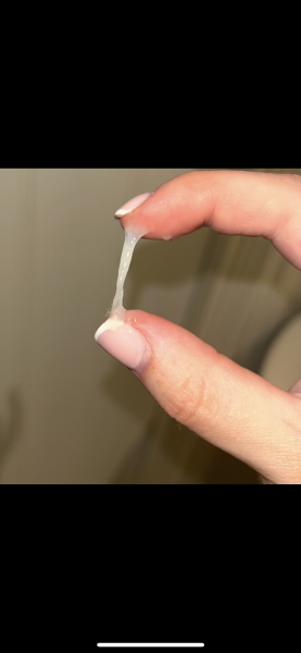 Mucus plug???