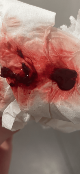 Is this a miscarriage