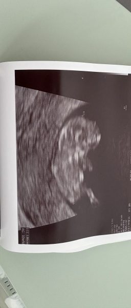 Skull Theory - Gender Prediction - Bit of fun!