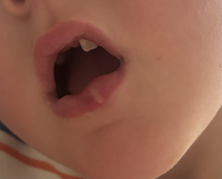 Has anyone seen this before? Swollen mouth?