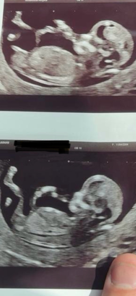 November 2025 #Thread 2 🤰🏻