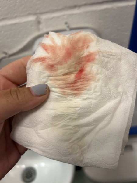 TW blood early pregnancy