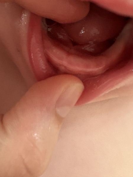 Does this look like the start of teething? Left hand side of gum.