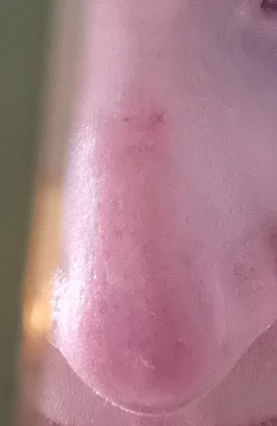 Red spot on nose for years