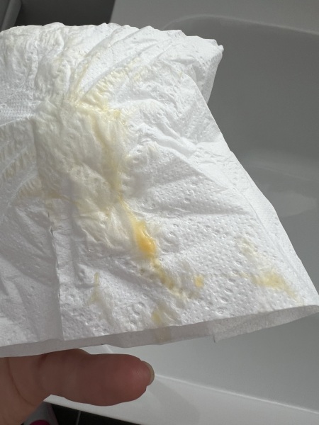 Ovulating or Infection??