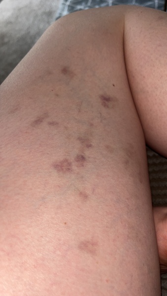 Weird purple marks