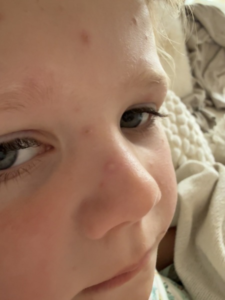 Last remaining blister - fly in 3 days!