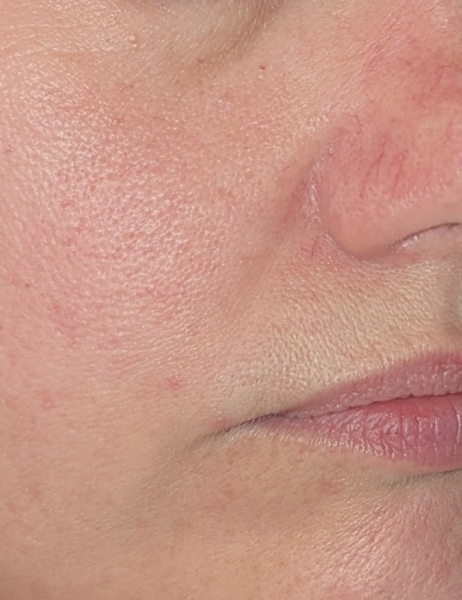 If this was your face, what skincare routine would you have?