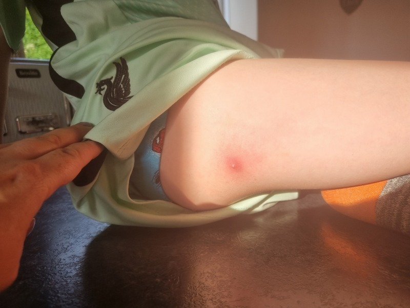 Molluscum or something else?