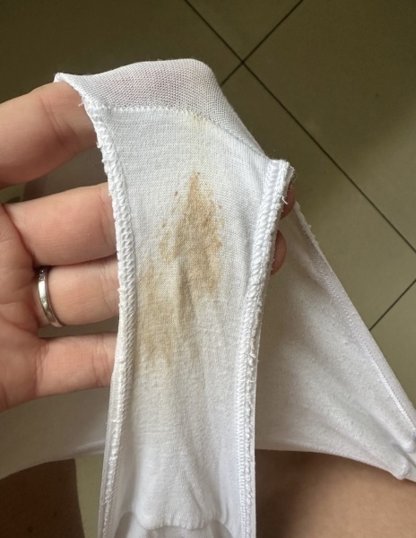 Light spotting at 4 weeks pregnant, should I worry? Image included