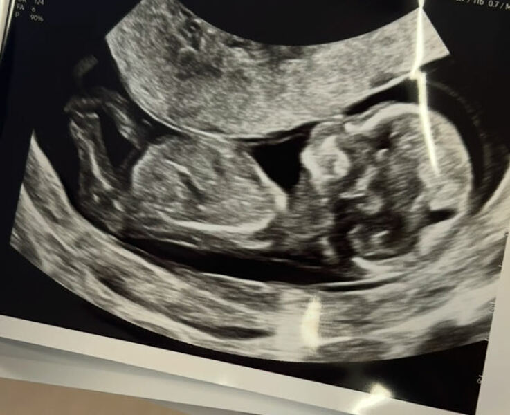 Due January 2026 - thread 2