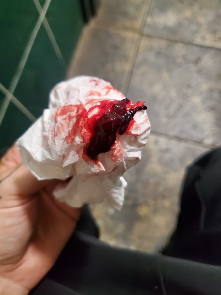 Period clotting