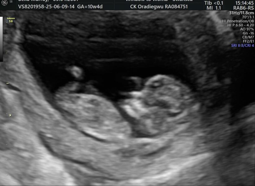 Due January 2026 ✨