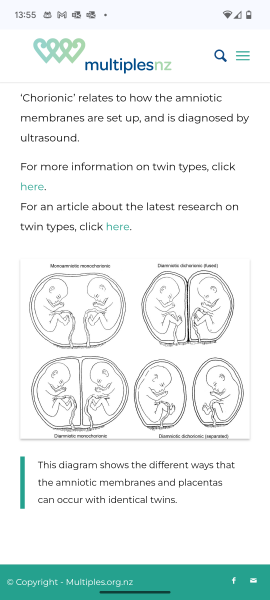 Are there four types of twins?
