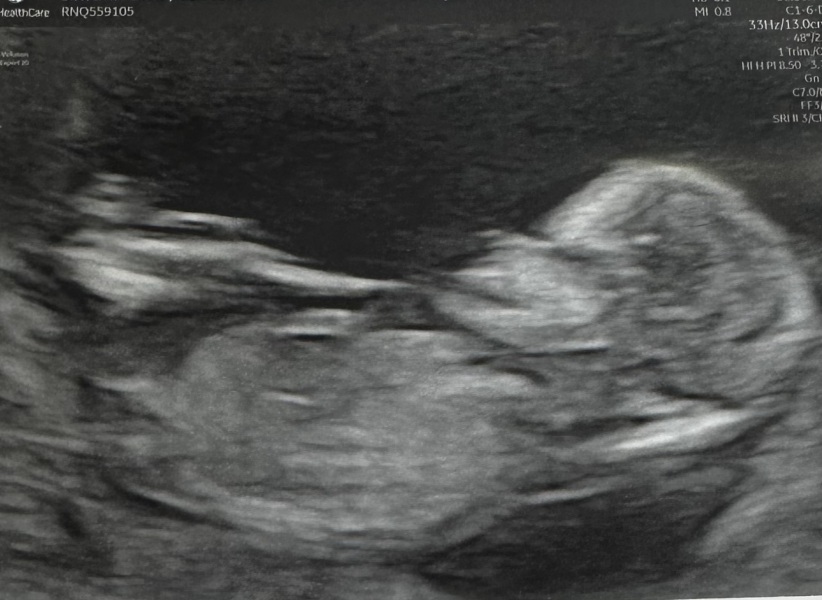 Boy or girl