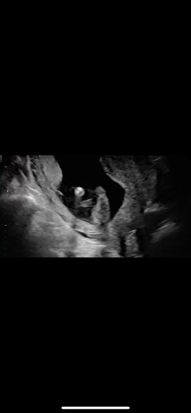It’s a BOY! But sooo confused about what the scan picture shows…please help!
