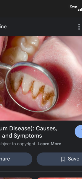 Are you surprised when someone in a professional role has bad teeth