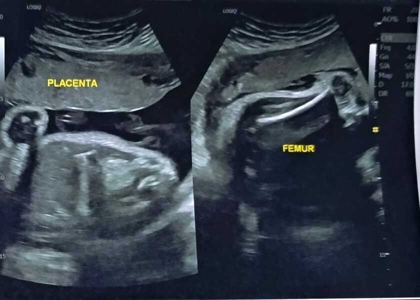 Boy or girl
