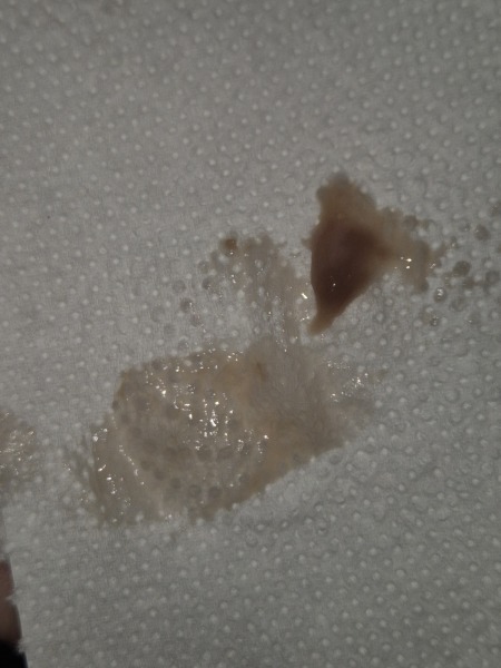 TMI WARNING brown ewcm 12dpo