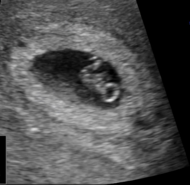 4th child and trying to hide my pregnancy