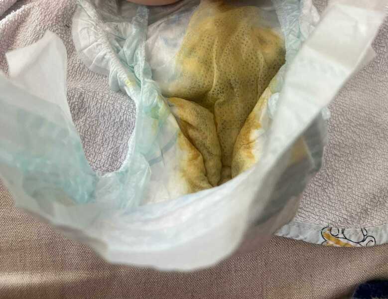 4 month old watery poo * pic included*