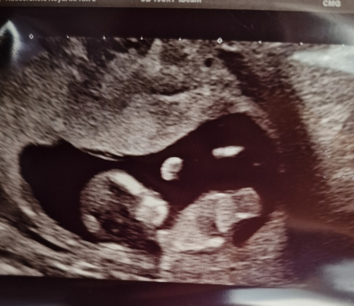 Due December 2025