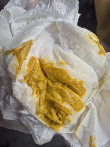 Does this look like normal poop for a 2month old?