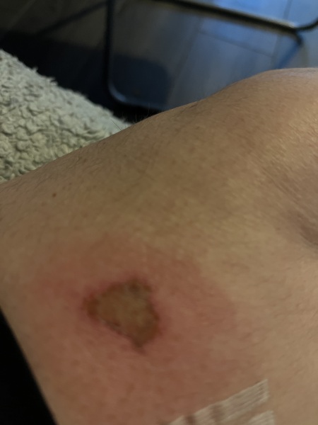 Does this look infected ?  Image included