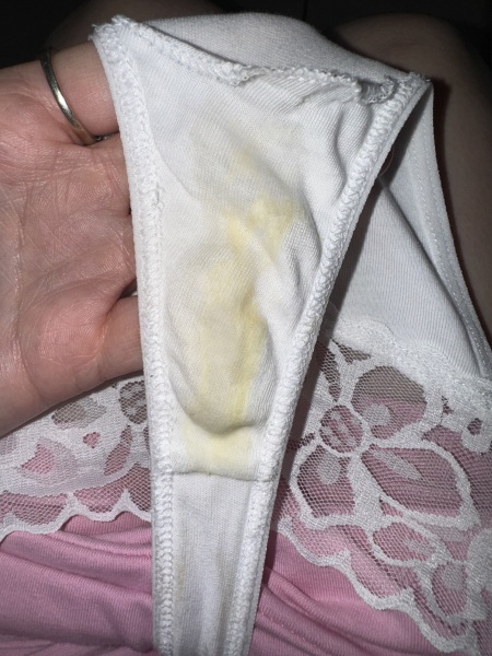 Yellow discharge 20 weeks pregnant