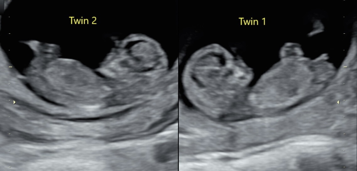 Gender guesses?