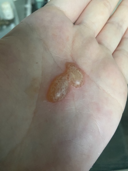 Anyone know what this is or what I can put on it?
