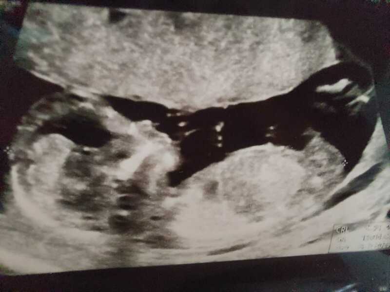 Anyone want me to take a look at their nubs?