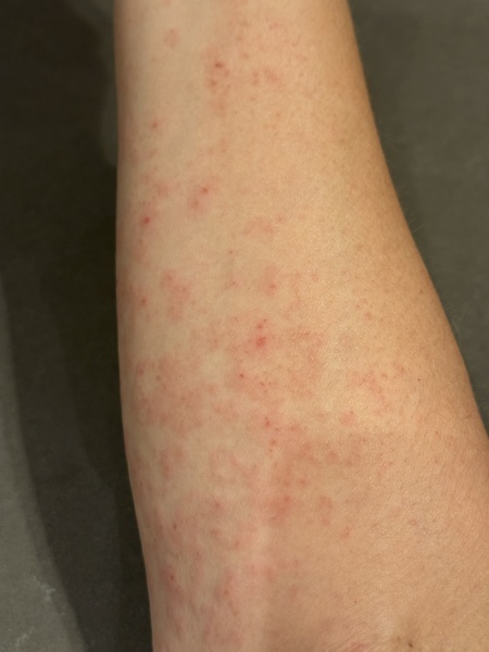 Mounjaro/Wegovy with > 5 stone/30kg to lose.  Thread 8!